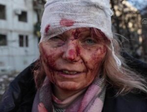 Rusya Ukrayna savaşından son dakika: Ukrayna bombardıman altında! Halk ülkeyi terk ediyor !